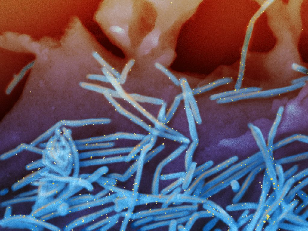 Scanning electron micrography of human respiratory syncytial virus (RSV) labeled with anti-RSV/gold antibodies shedding from surface of human lung A549 cultured cell.